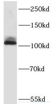 KDM1A Rabbit Polyclonal Antibody