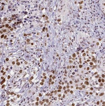 KDM1A Rabbit Polyclonal Antibody