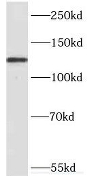 KDM2A Rabbit Polyclonal Antibody