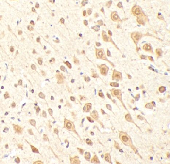 KDM2A Rabbit Polyclonal Antibody