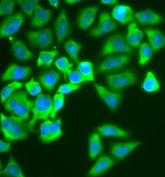 KEAP1 Rabbit Polyclonal Antibody