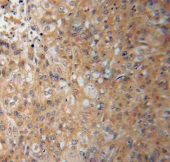 KEAP1 Rabbit Polyclonal Antibody