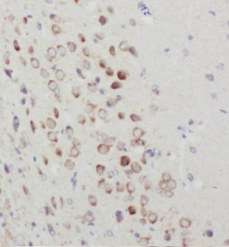 KIAA0319L Rabbit Polyclonal Antibody