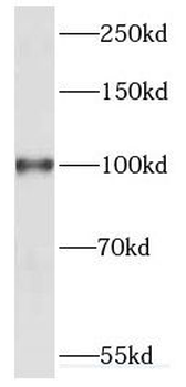 KIF20A Rabbit Polyclonal Antibody