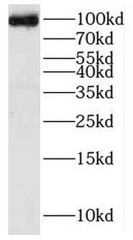 KIF2A Rabbit Polyclonal Antibody