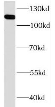 KIF5B Rabbit Polyclonal Antibody