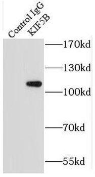 KIF5B Rabbit Polyclonal Antibody