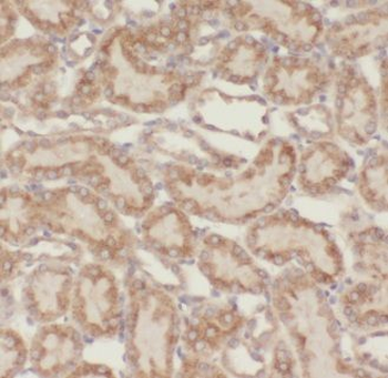 KIF5B Rabbit Polyclonal Antibody