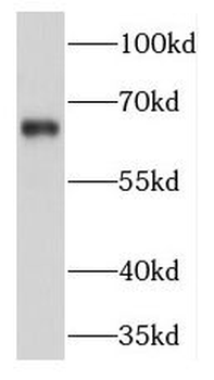 KIFC1 Rabbit Polyclonal Antibody