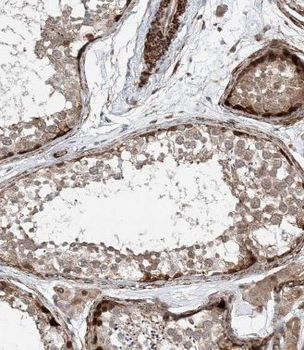 KIFC1 Rabbit Polyclonal Antibody