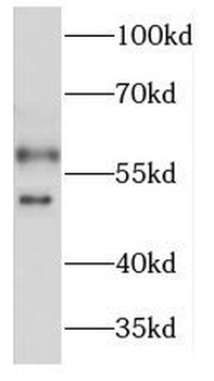 KCNJ2 Rabbit Polyclonal Antibody