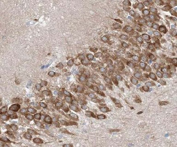 KCNJ2 Rabbit Polyclonal Antibody