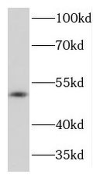 KIR3DL1 Rabbit Polyclonal Antibody