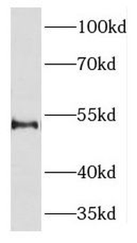 KLF10 Rabbit Polyclonal Antibody