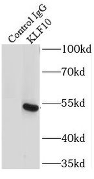 KLF10 Rabbit Polyclonal Antibody