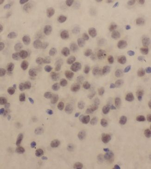 KLF13 Rabbit Polyclonal Antibody