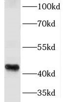 KLF6 Rabbit Polyclonal Antibody