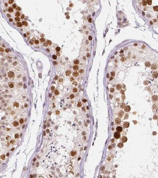 KLF6 Rabbit Polyclonal Antibody