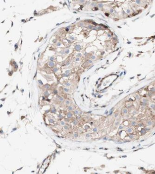 KLHL12 Rabbit Polyclonal Antibody