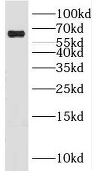 KLHL20 Rabbit Polyclonal Antibody