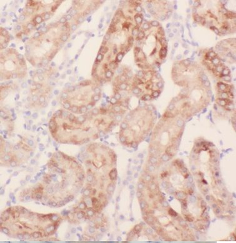 KLHL20 Rabbit Polyclonal Antibody