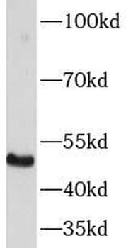KRT12 Rabbit Polyclonal Antibody