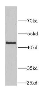 KYNU Rabbit Polyclonal Antibody