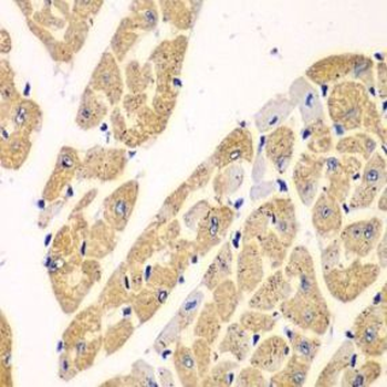 KYNU Rabbit Polyclonal Antibody