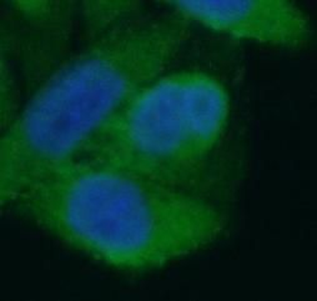 LACTB Rabbit Polyclonal Antibody