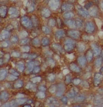 LACTB Rabbit Polyclonal Antibody