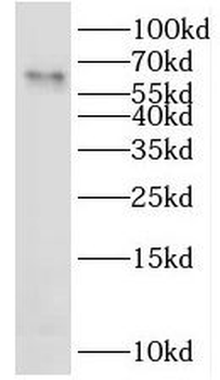 LAD1 Rabbit Polyclonal Antibody