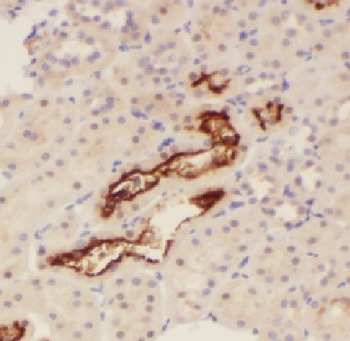 LAD1 Rabbit Polyclonal Antibody