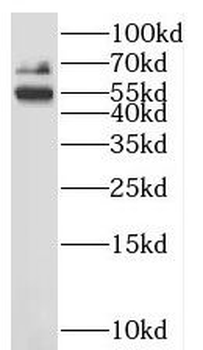 LAG3 Rabbit Polyclonal Antibody