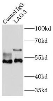 LAG3 Rabbit Polyclonal Antibody