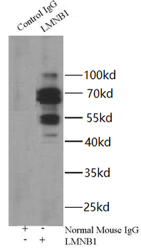 LMNB1 Mouse Monoclonal Antibody