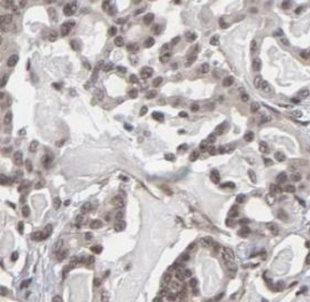 LMNB1 Mouse Monoclonal Antibody