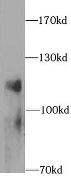 LAMP1 Rabbit Polyclonal Antibody