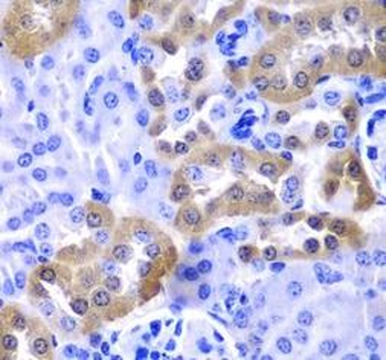LAMP1 Rabbit Polyclonal Antibody