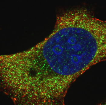 LAMP1 Rabbit Polyclonal Antibody