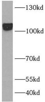 LAMP2 Rabbit Polyclonal Antibody