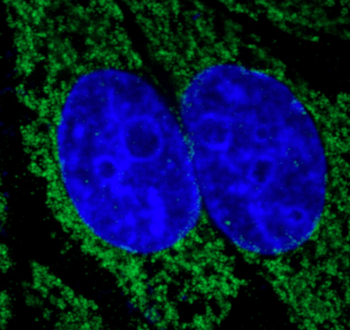 LAMP2 Rabbit Polyclonal Antibody