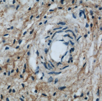 LAMP2 Rabbit Polyclonal Antibody