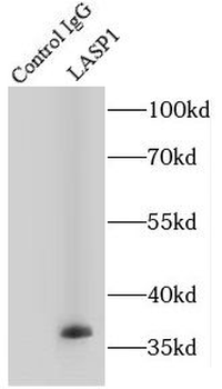 LASP1 Rabbit Polyclonal Antibody