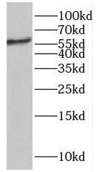 LBR Rabbit Polyclonal Antibody