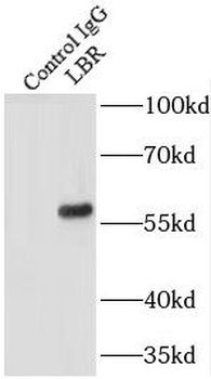 LBR Rabbit Polyclonal Antibody