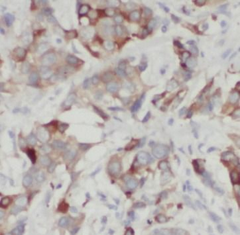 Cleaved LC3 Rabbit Polyclonal Antibody