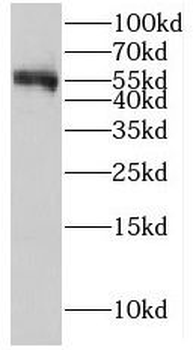 LCAT Rabbit Polyclonal Antibody