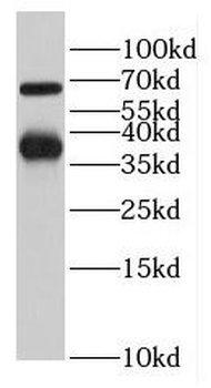 LCTL Rabbit Polyclonal Antibody