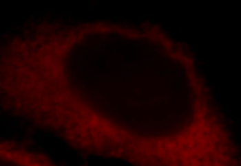 LDHA Rabbit Polyclonal Antibody