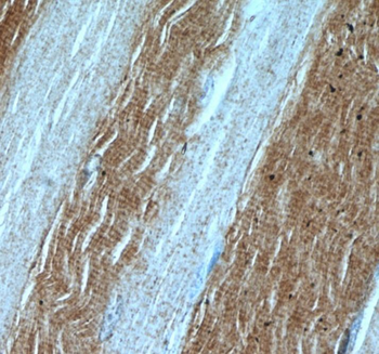 LDHA Rabbit Polyclonal Antibody